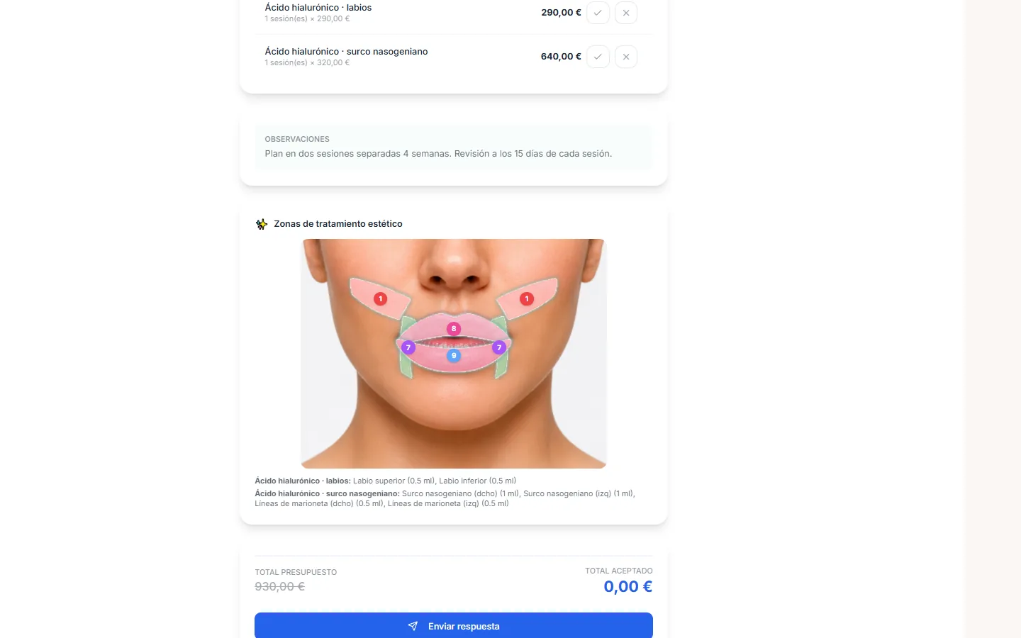 Mapa facial de Clinical Scale con las zonas de armonización orofacial marcadas y la dosis en mililitros de cada una