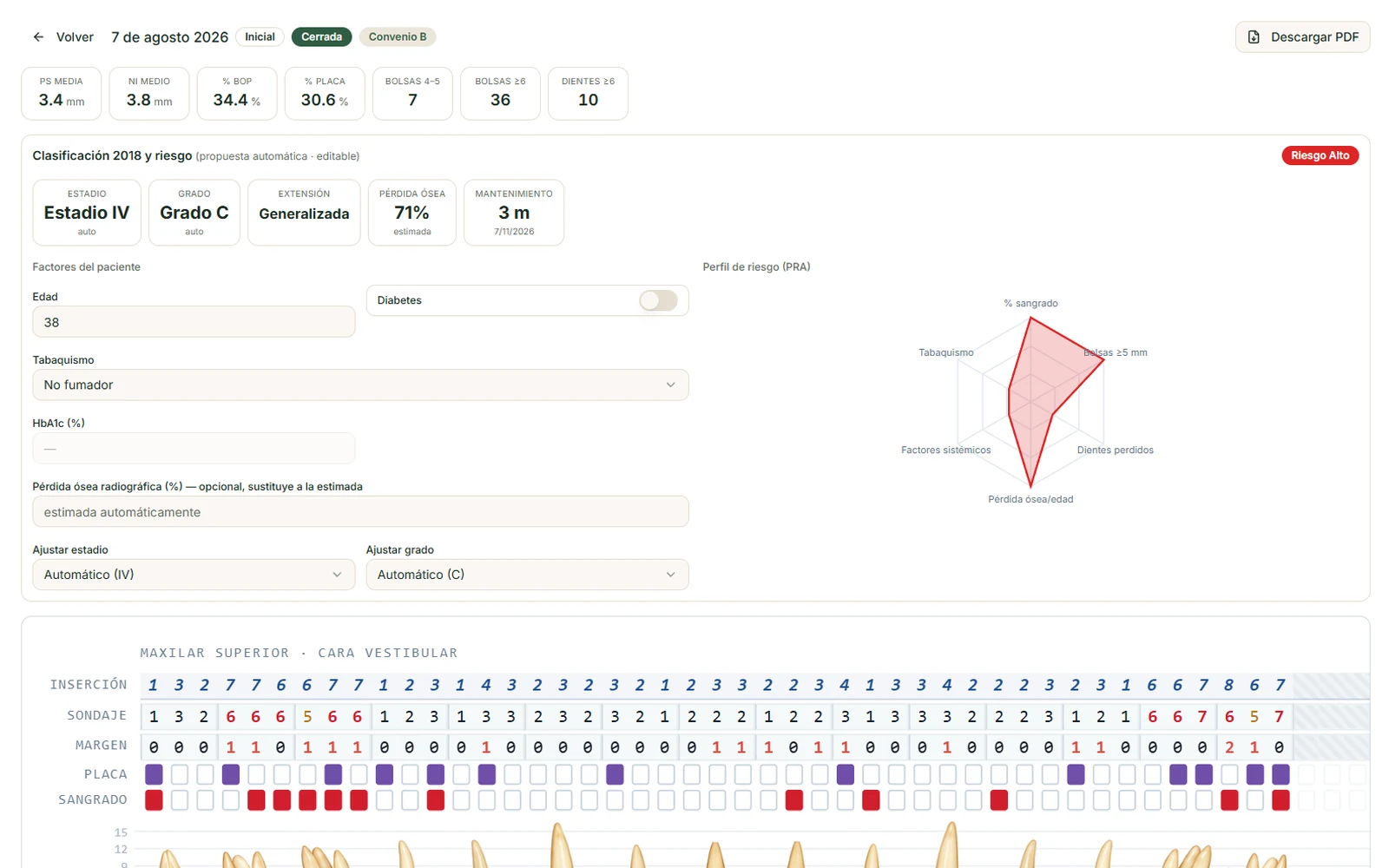 Periodontograma de Clinical Scale con sondaje, índice de placa y clasificación periodontal calculada automáticamente